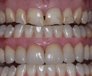 Estética dental y restauradora